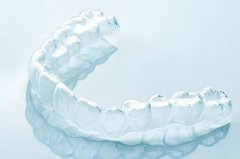 隐适美矫正大概多少钱？隐适美矫正后保持器要戴多久？